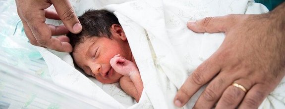 تولد نوزاد دختری با شش انگشت در پاها و و دست ها