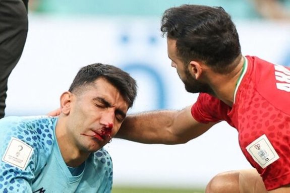 لحظه دلخراش برخورد بیرانوند و حسینی در بازی ایران انگلیس + عکس