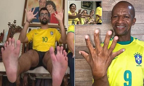 ۱۲ انگشتی های برزیلی که عاشق فوتبال هستند! + تصاویر