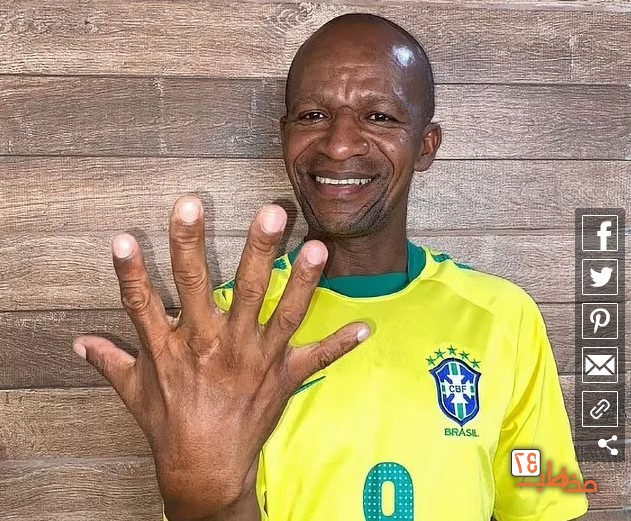 خانواده ۱۲ انگشتی برزیلی که عاشق فوتبال هستند! + تصاویر