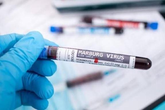 کشورهای عربی به مسافران درباره ویروس «ماربورگ» هشدار دادند
