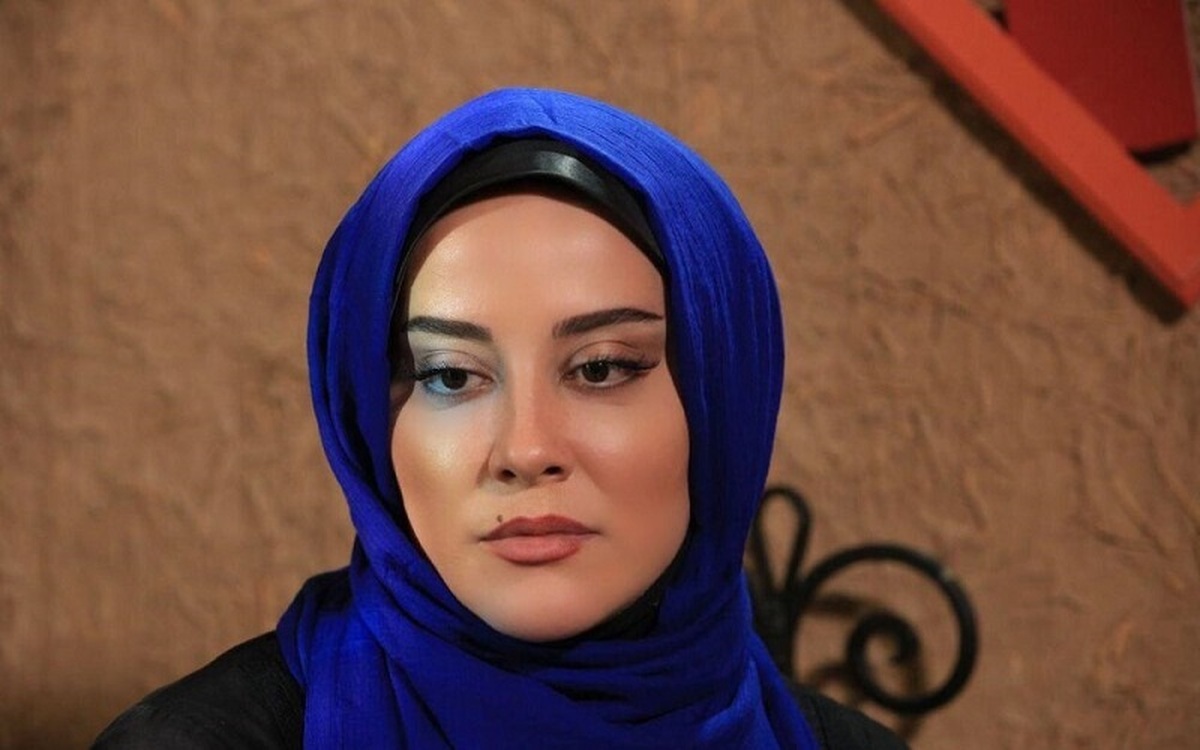 (عکس) چهره خانم بازیگر پس از عمل جراحی