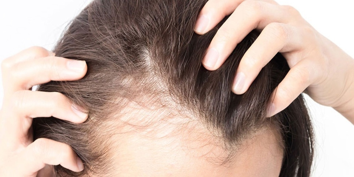 جلوگیری از ریزش مو با این توصیه ساده طب‌سنتی