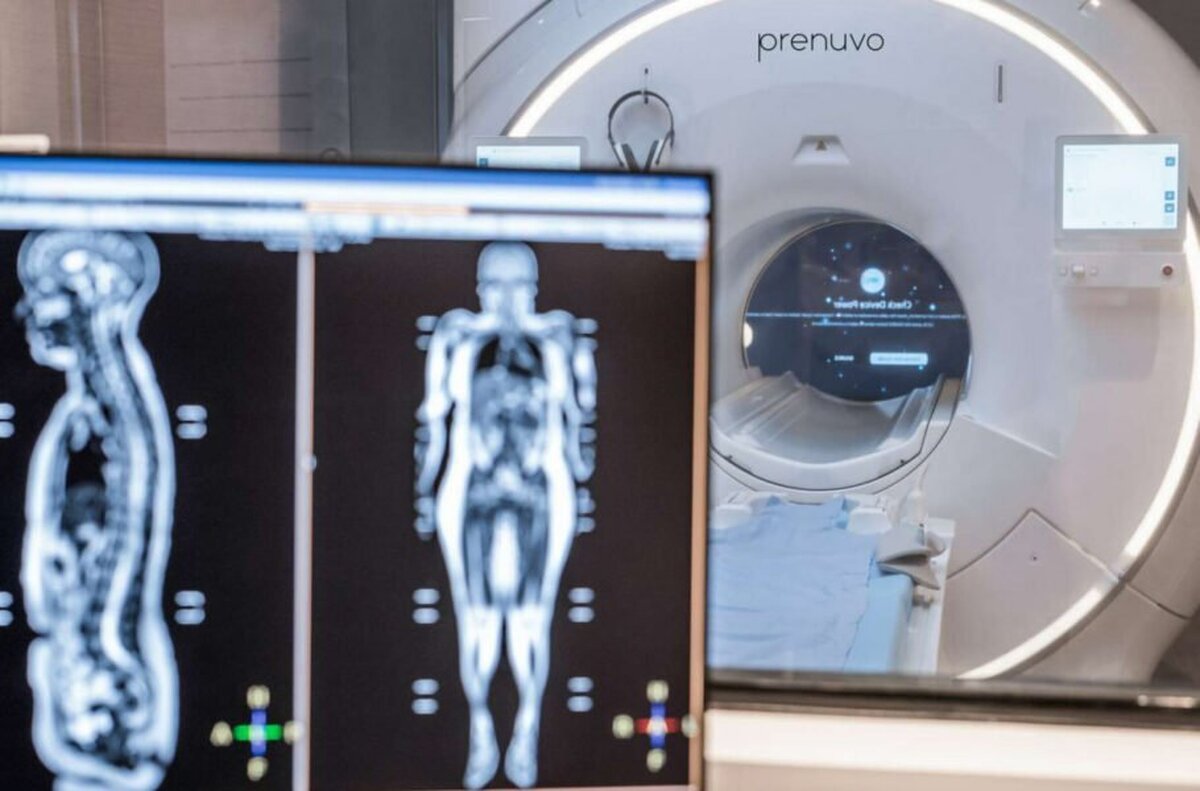 هزاران نفر برای روش جدید اسکن سرطان صف بسته‌اند؛ ۲۵۰۰ دلار در اِزای MRI کامل بدن