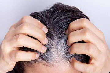 راهکار جلوگیری از خاکستری شدن مو‌ها