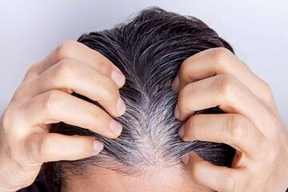 راهکار جلوگیری از خاکستری شدن مو‌ها