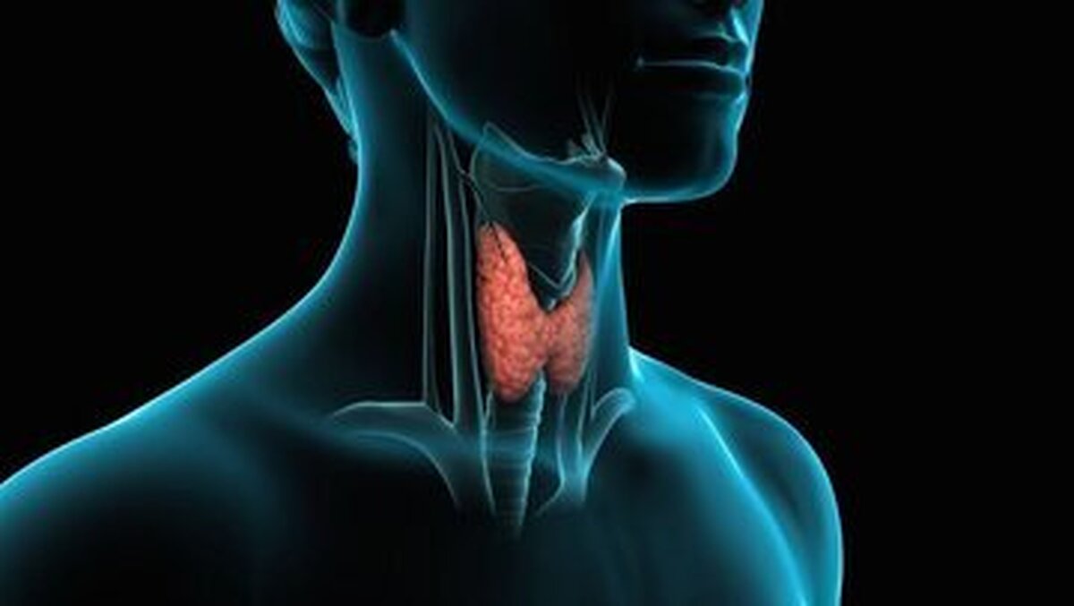 اختلالات تیروئیدی در زنان ۸ الی ۱۰ برابر بیشتر از مردان