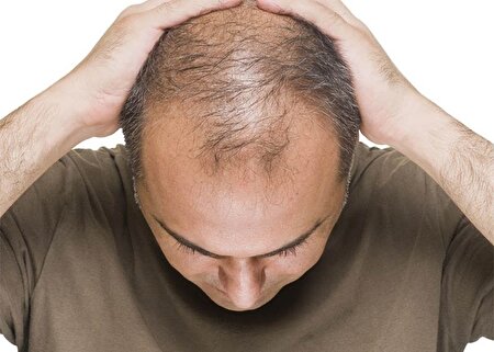مصرف این ویتامین ریزش مو را قطع می‌کند