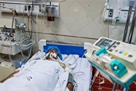 ۵ علامت هشدار دهنده سکته مغزی
