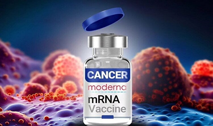 آغاز درمان بیماران با واکسن mRNA سرطان در روسیه