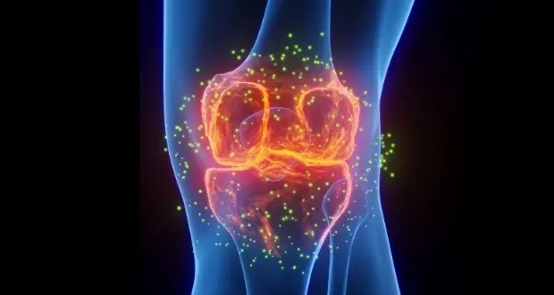 بهترین درمان برای درد مفاصل