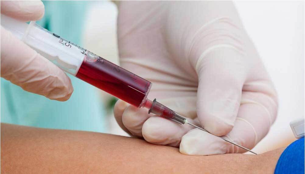 ۵ آزمایشی که پس از چهل‌ سالگی ضروری است