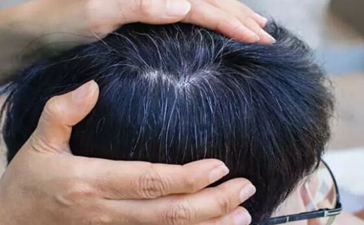 یافته‌ای جدید درباره سفید شدن مو