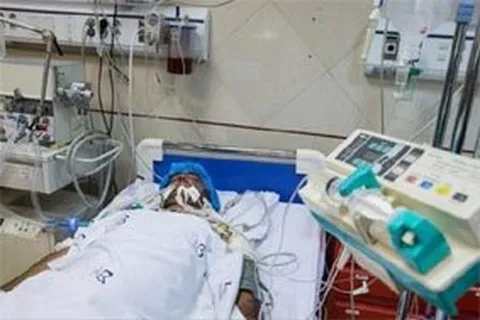 ۵ علامت هشدار دهنده سکته مغزی
