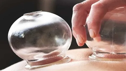 حجامت باعث لاغری و افزایش قد می&zwnj;شود؟