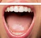 بی حسی زبان را جدی بگیریم