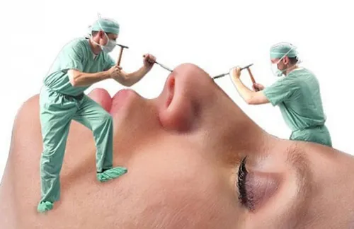 دلالی جراحی&zwnj;های زیبایی در فضای مجازی