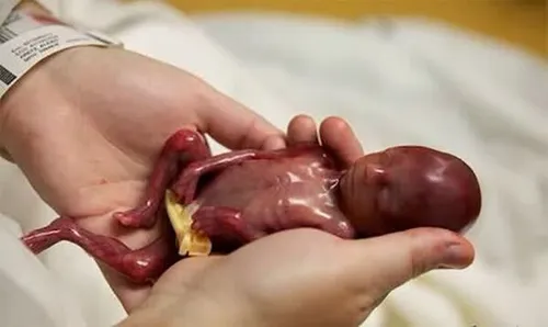 سقط جنین در پاریس مجازات دارد؟