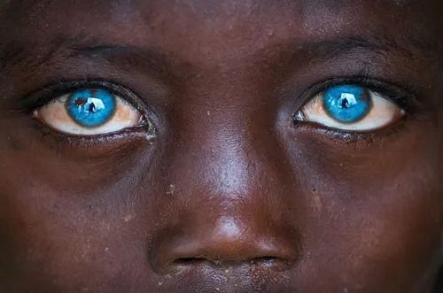 چشم آبی&zwnj;ها بخوانند!