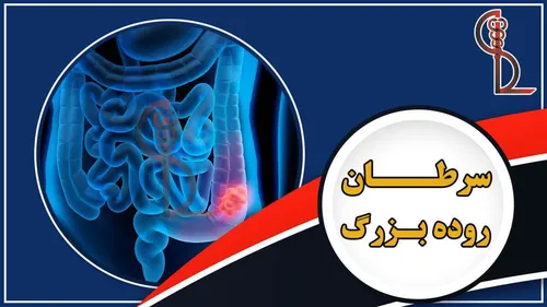 زنگ خطر افزایش یک سرطان در ایران


هشدار؛ زنگ خطر افزایش یک سرطان در ایران