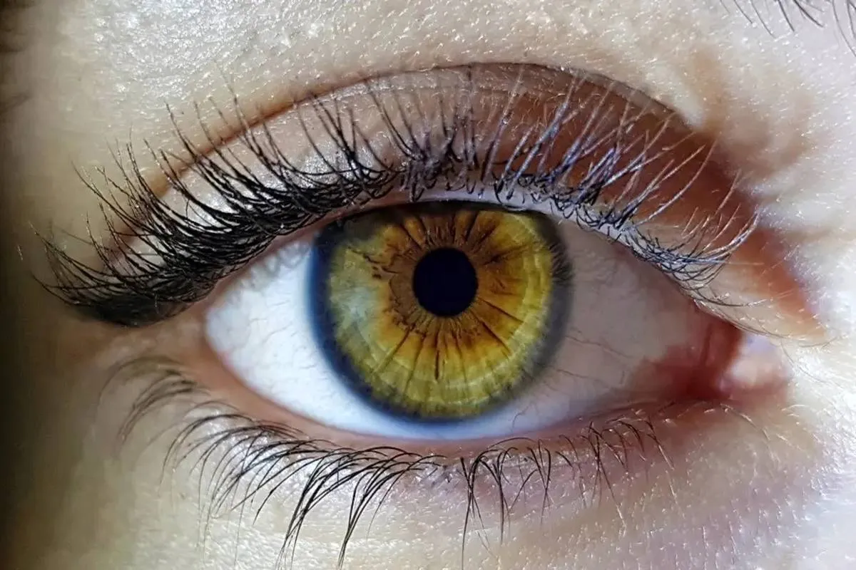 عوارض خطرناک تتو قرنیه