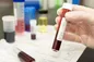 ماجرای افشای اطلاعات محرمانه بیماران HIV